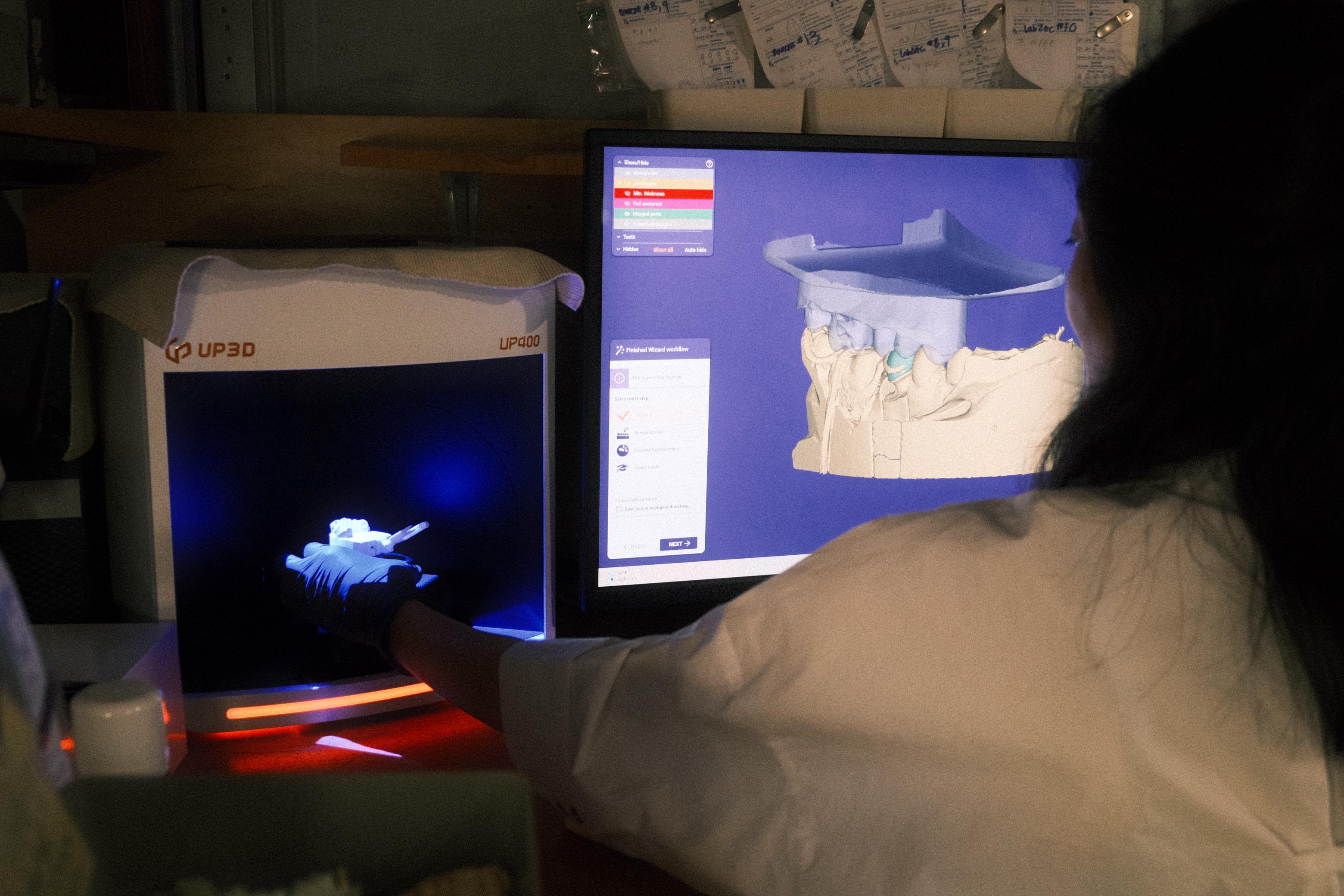 Technician reviewing a 3D intraoral scan on the lab's design screen